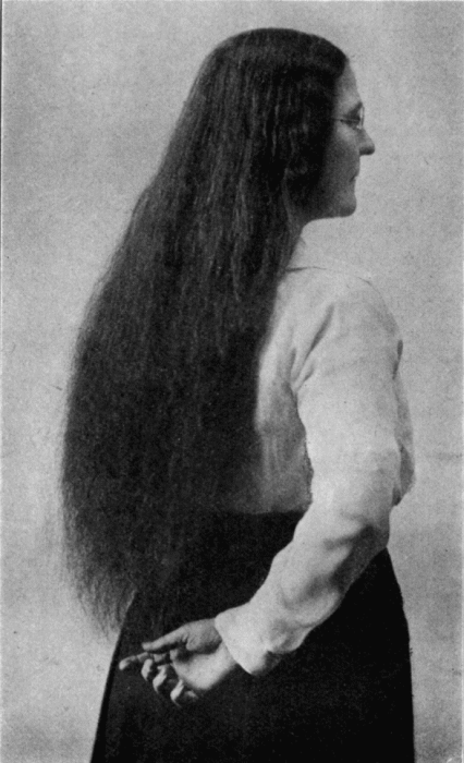 "A Gift from God"&mdash;Five Years' Growth.
(Photographed Jan. 29, 1917)